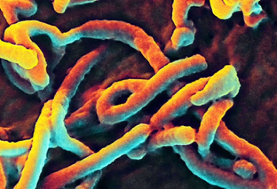 Судлаачид Эбола вирус хүний бие махбодийн дархлааны хамгаалалтыг хэрхэн идэвхигүй болгодог талаар олж мэджээ