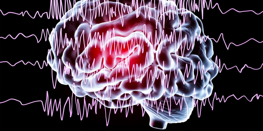 Ургийн болон хүүхдийн тархины гэмтэл эпилепси үүсгэдэг
