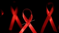 ХДХВ, ДОХ-ын халдвар тээгчдийн 80 хувийг эрэгтэйчүүд эзэлдэг